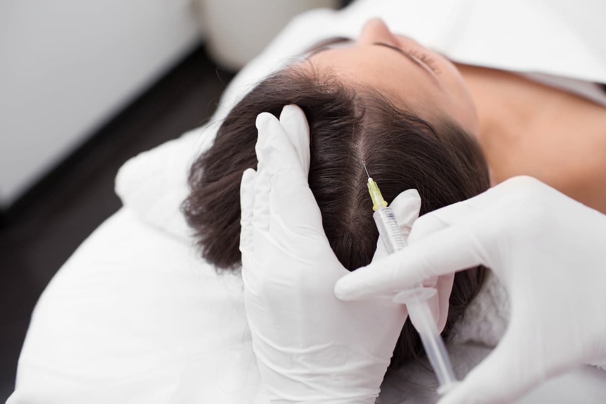 woman-receiving-scalp-treatment-with-injectables-2026-03-24-00-30-28-utc (2)