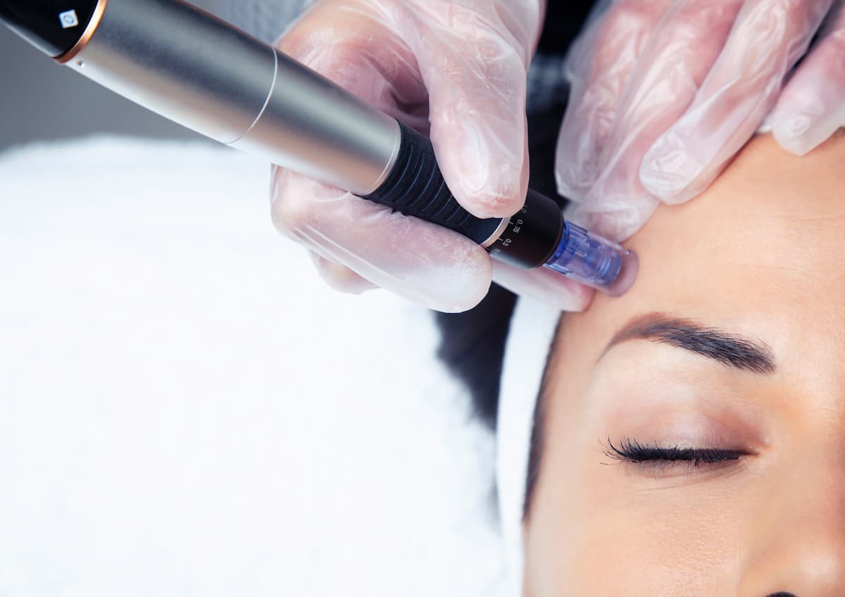 cosmetologist-making-mesotherapy-injection-with-de-2026-03-09-03-45-55-utc (2)