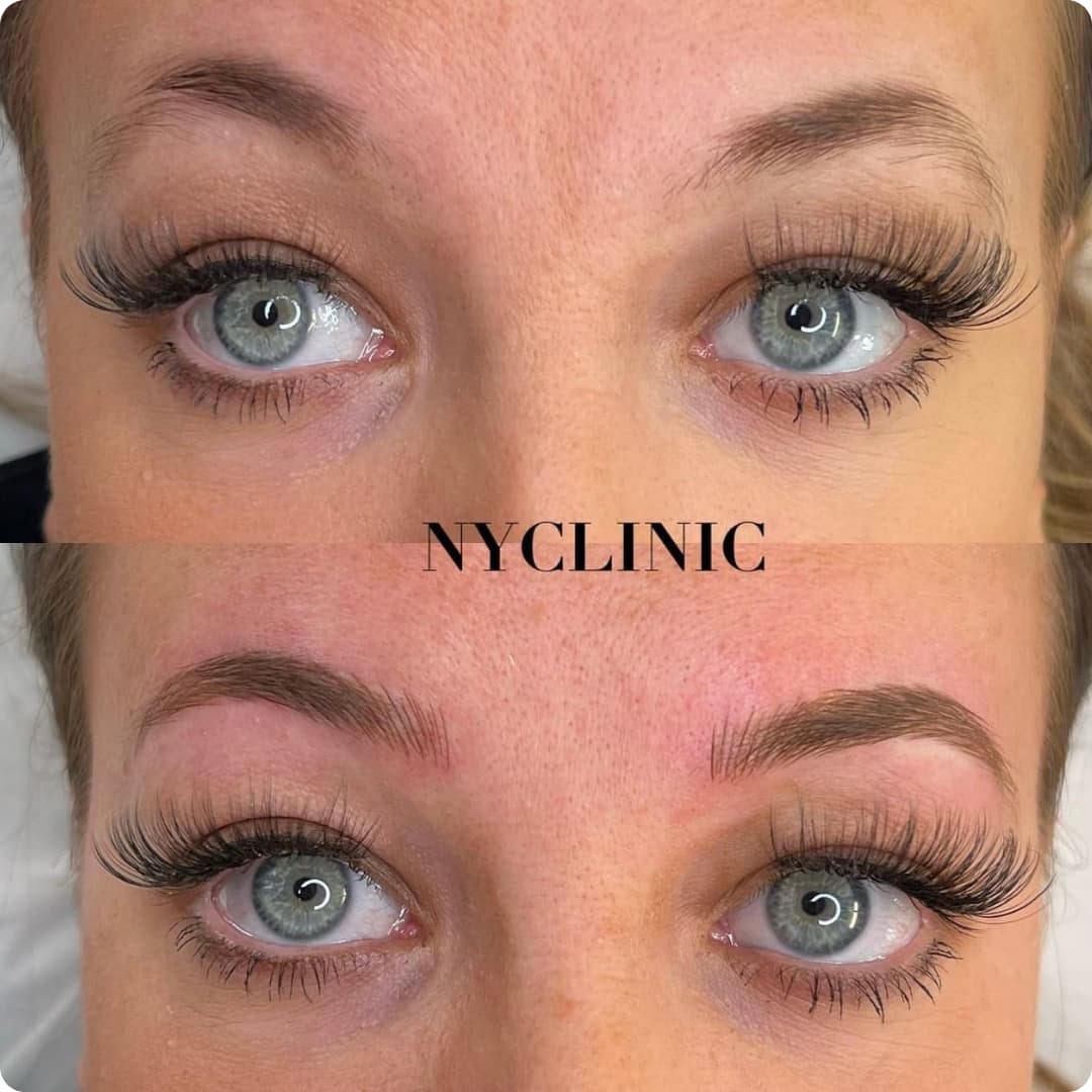 Client result
