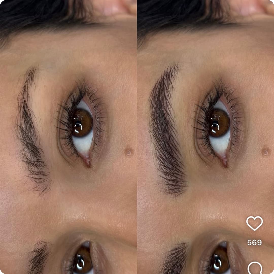 Client result