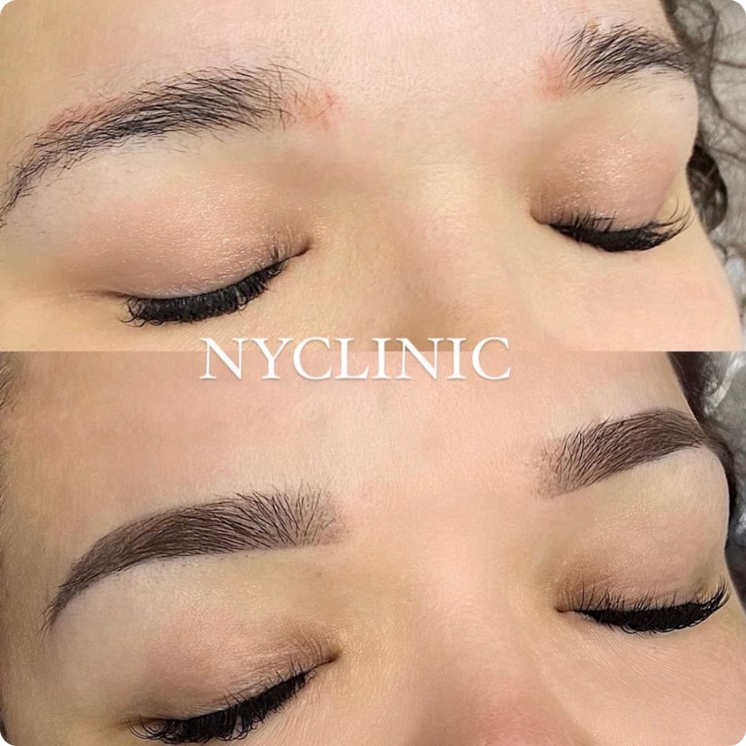 Client result