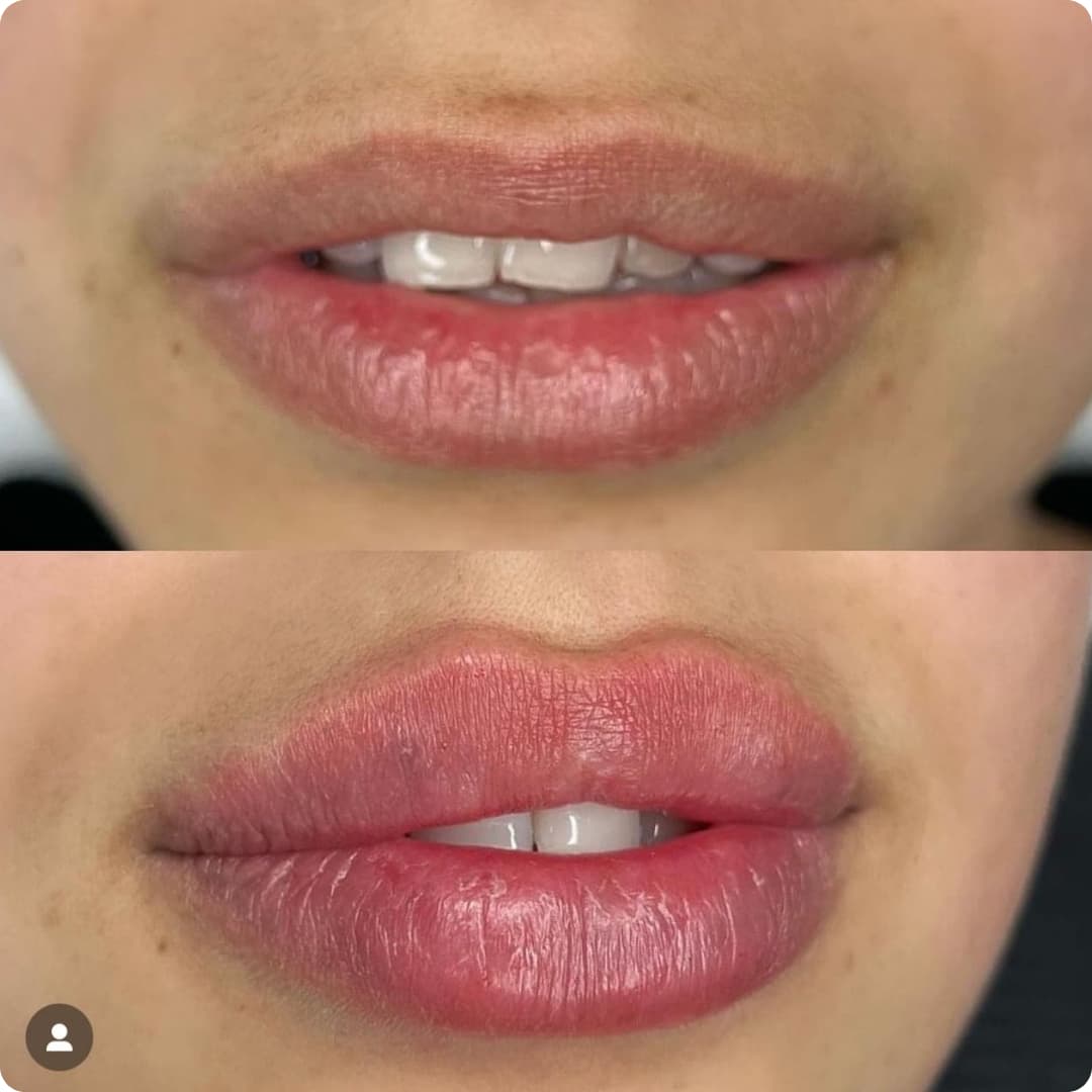 Client result