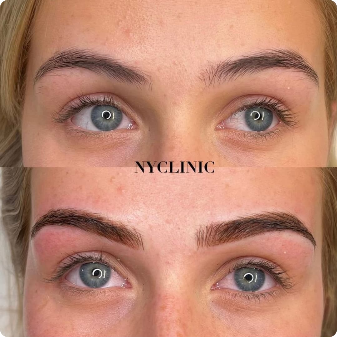 Client result
