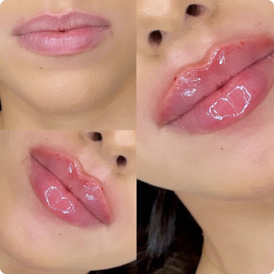 Client result