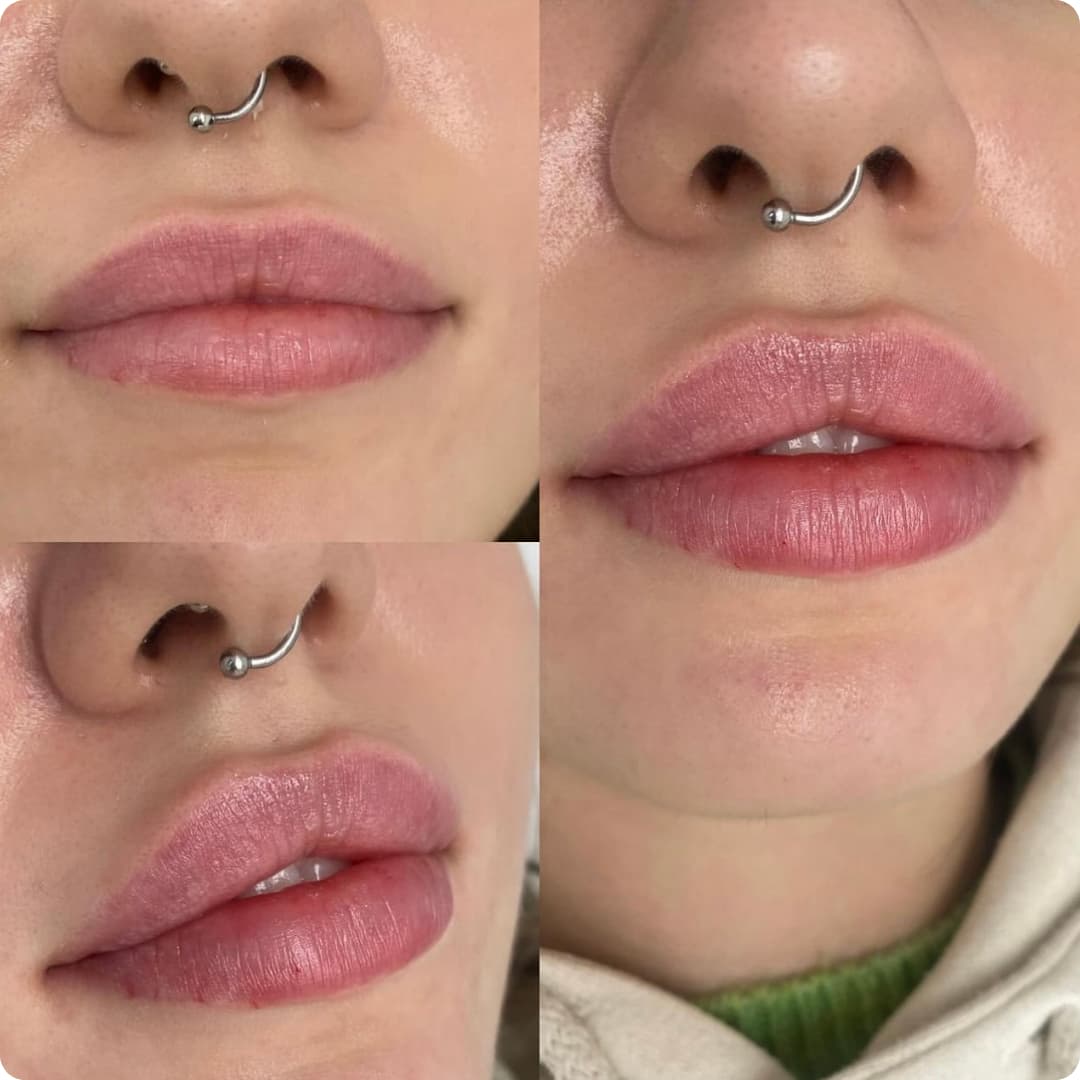 Client result