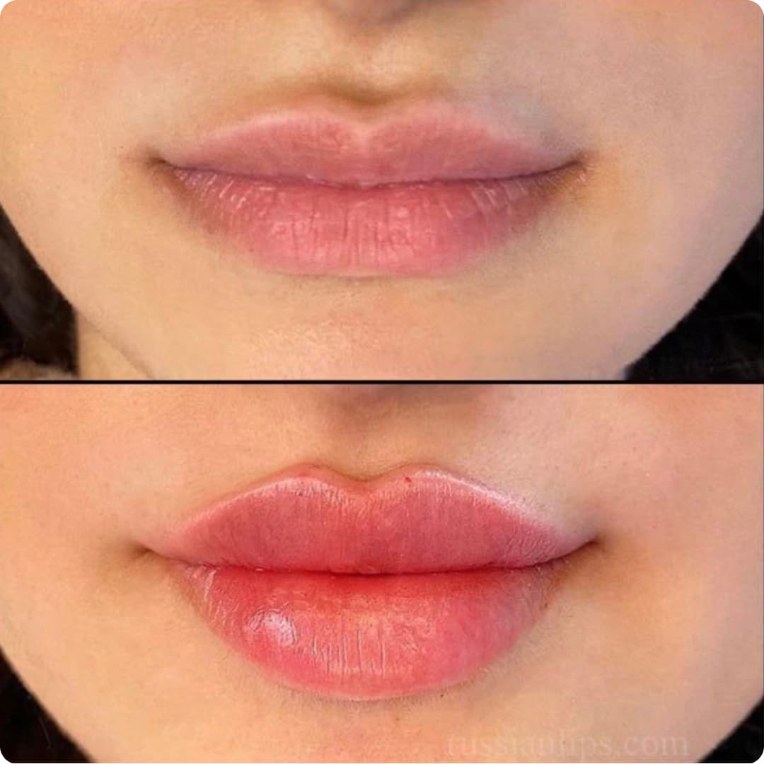 Client result