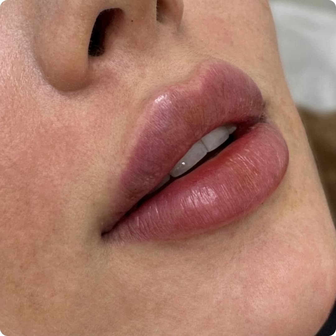 Client result