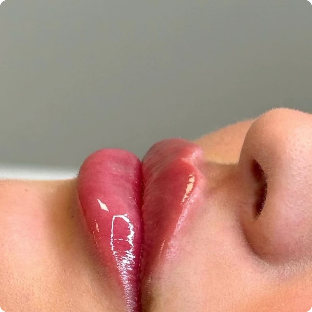 Client result