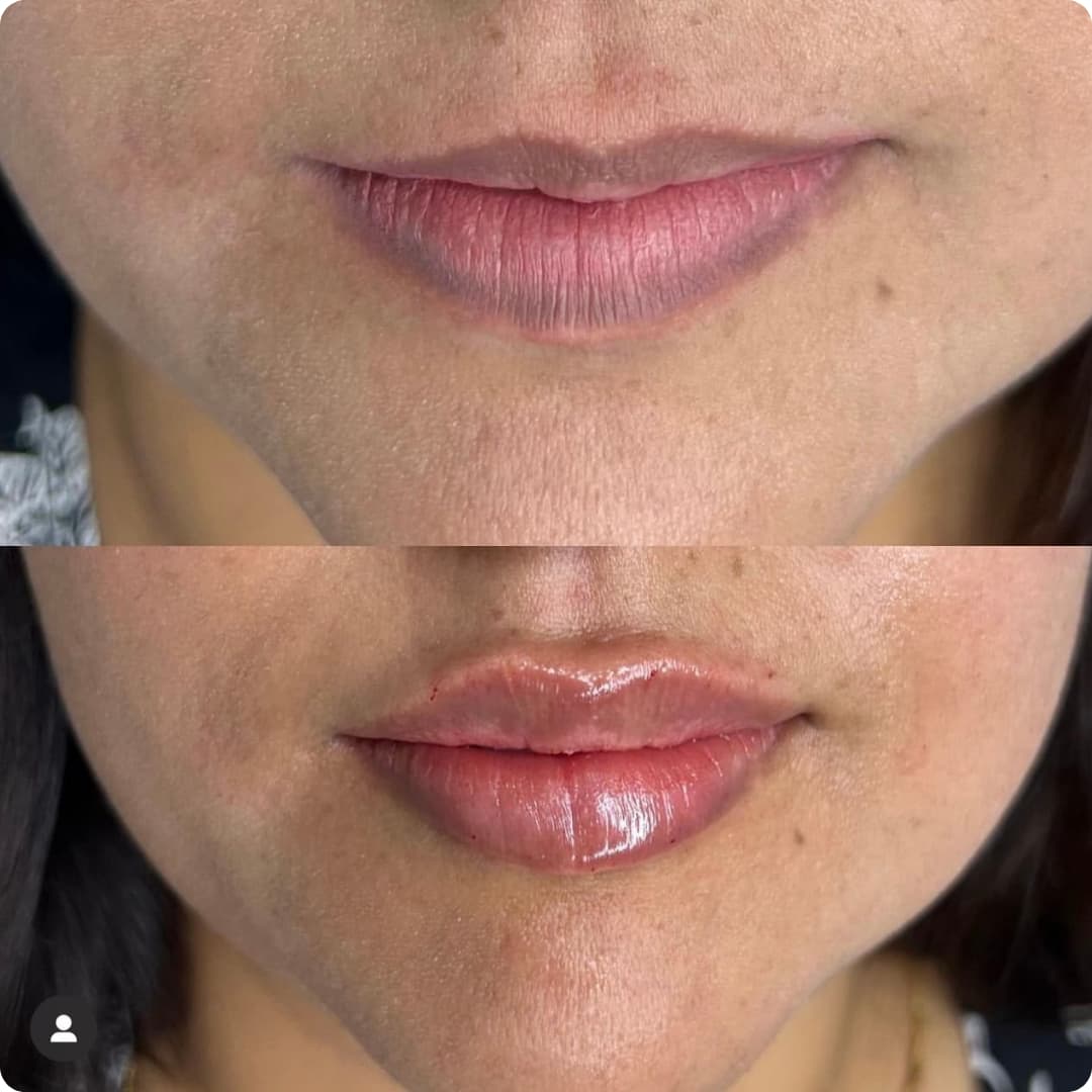 Client result