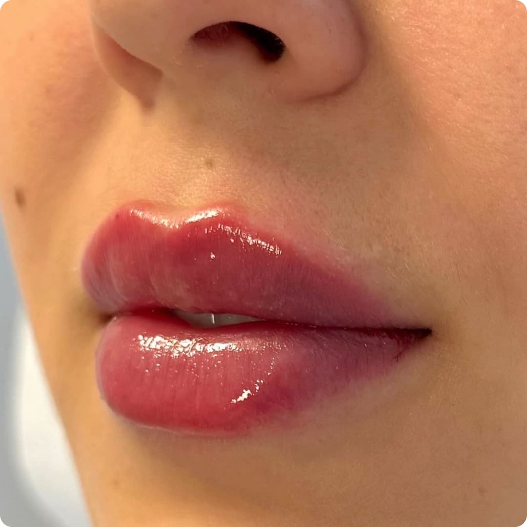 Client result