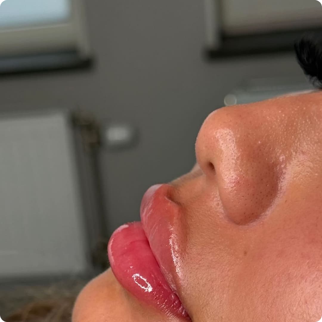 Client result