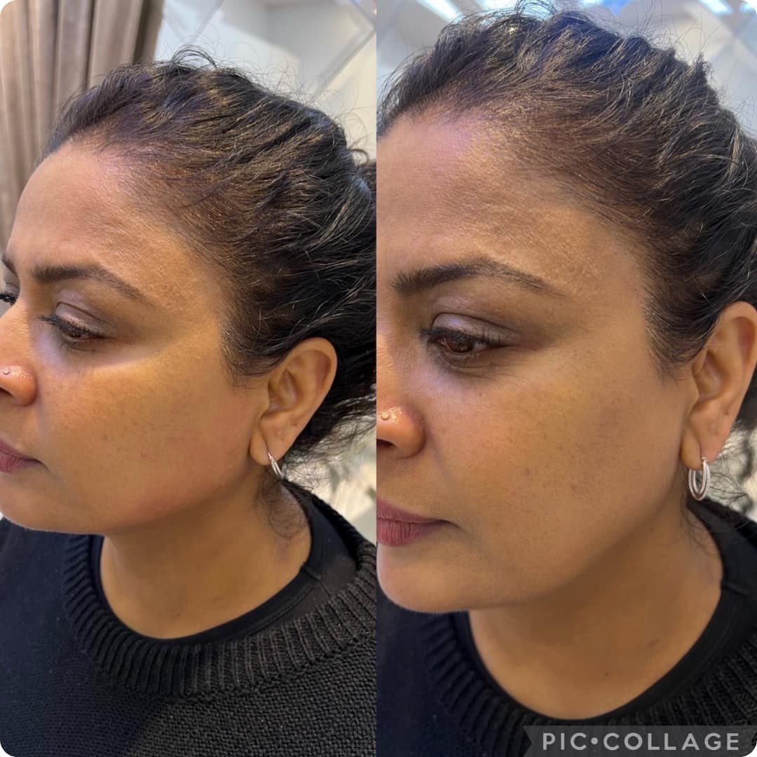 Client result