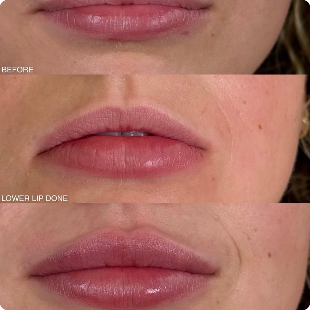 Client result