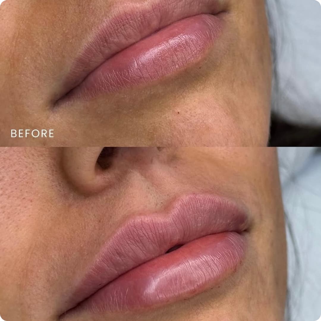Client result