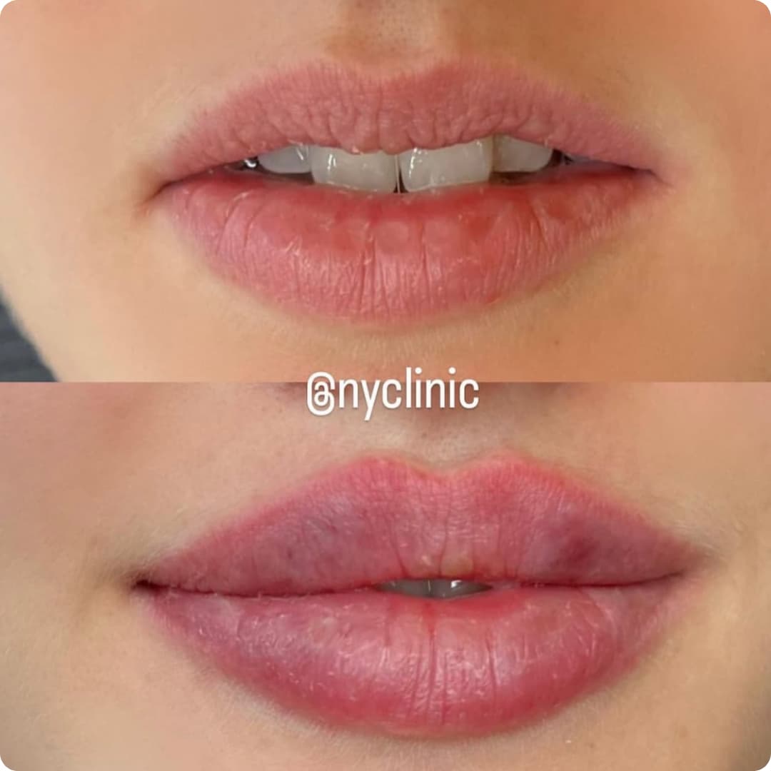 Client result