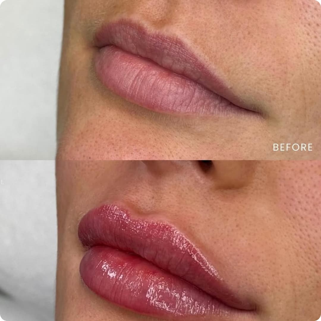 Client result