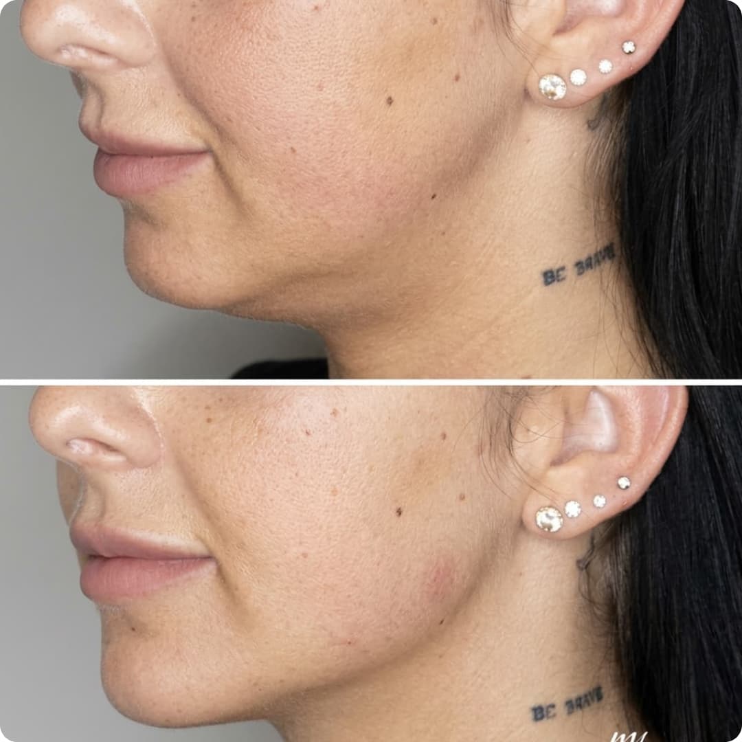 Client result