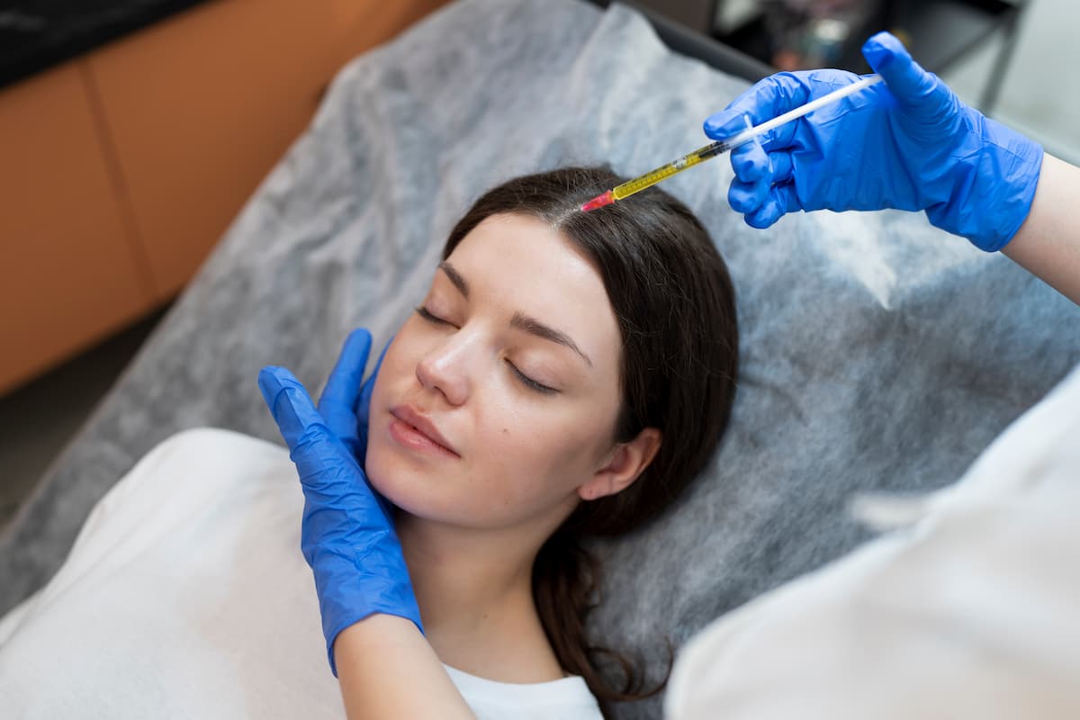 PRP Therapy for Hair Restoration: Benefits, Treatment and Cost in Barkingside, Ilford